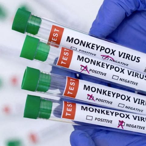 Four Monkeypox virus test vials held in a gloved hand